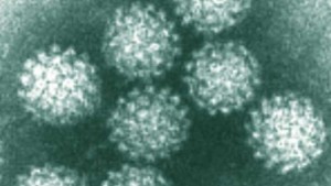 Existen diversos métodos de detección del Virus de Papiloma Humano 